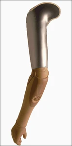 Protézy pro amputace a vrozené vady v lokti, paži a pletenci ramenním